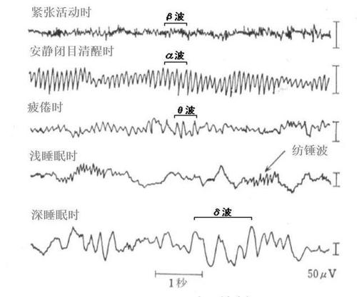 什么是脑电波?意念控制,离我们还有多远?