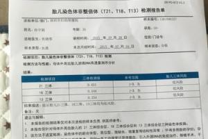 35岁包含35岁做dna,属于宝宝基因排畸的一种筛查,35岁的孕妇如果做