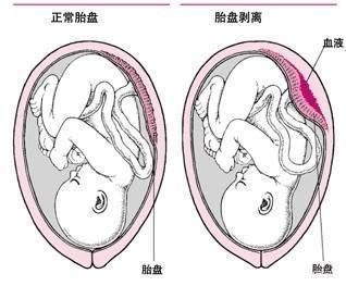 你的胎盘是