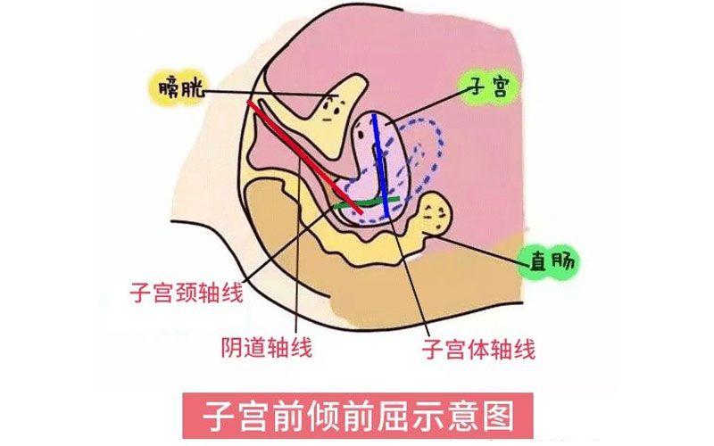 子宫前位位置图