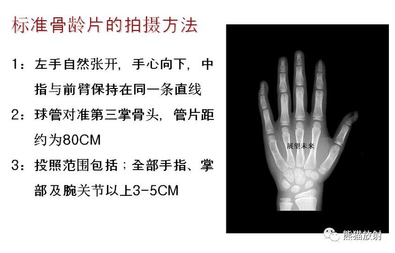 收藏丨骨龄图谱方便随时对照