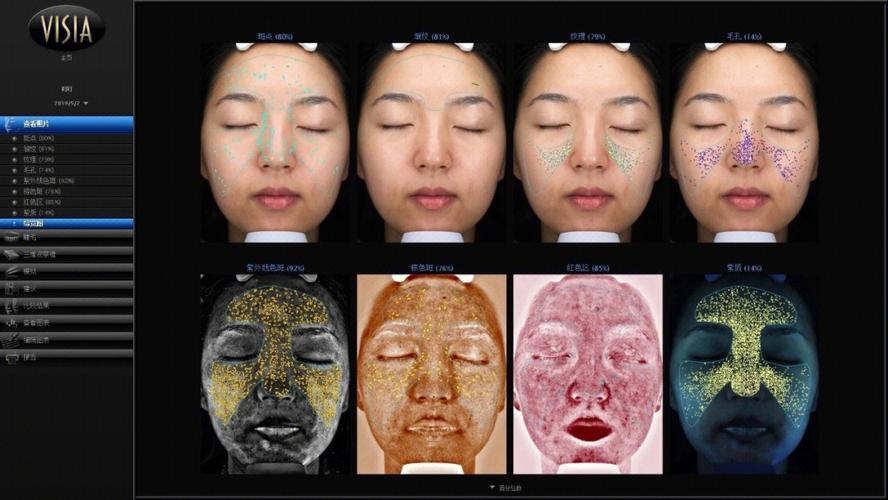 visia皮肤检测仪 又被称为皮肤的
