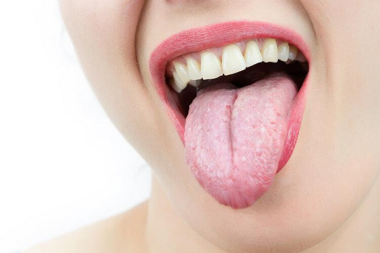 舌头边缘有齿痕是什么原因舌头边缘有齿痕怎么办