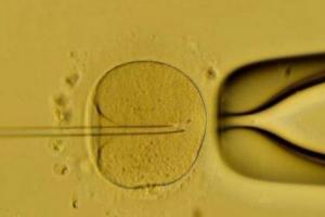 试管婴儿取卵后肚子不舒服是什么原因 反复取卵对卵巢有影响吗