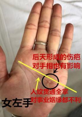3,30岁女士的手相:纹路有个疤痕,后天形成的伤疤对手相也有影响.
