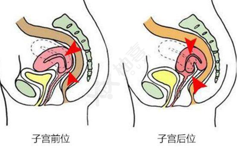 子宫前位不影响怀孕几率!不过它的优缺点得知道