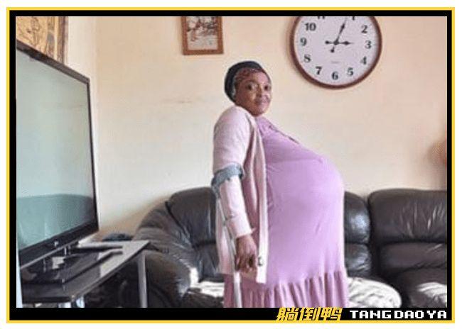 南非孕妇生下十胞胎本人已被送往精神病院